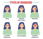 Different-types-of-headaches.jpg