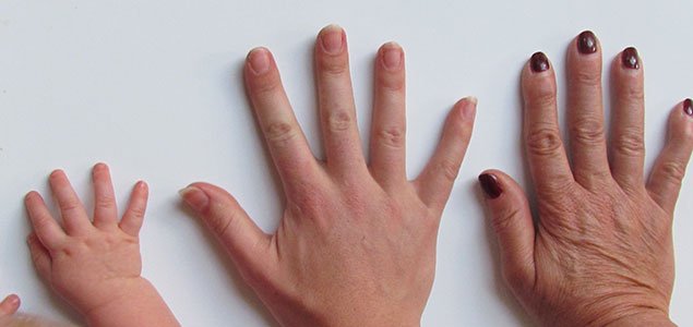 أمراض الأظافر الأسباب والعلاج Nail Problems طبيب دوت كوم